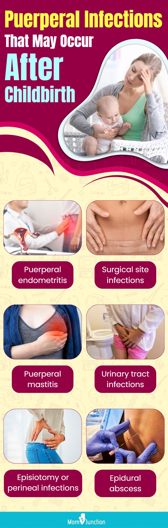 puerperal infections that may occur after childbirth(infographic)
