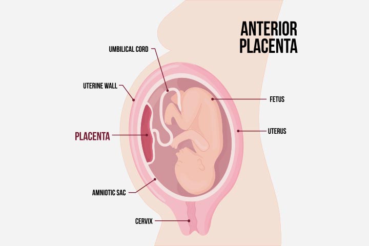 The placental site may be responsible for heavy bleeding 