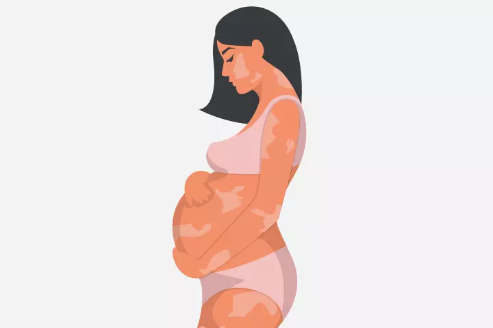 Skin Pigmentation Is Common