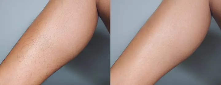 The Gender Of The Baby Affects The Amount Of Hair Growth