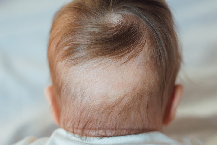Babies Experience Hair Loss