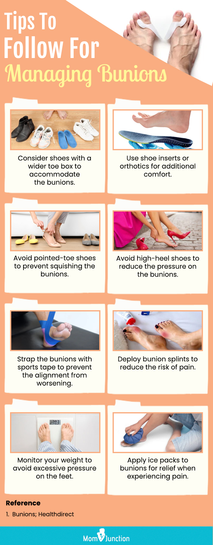 Tips To Follow For Managing Bunions (infographic)