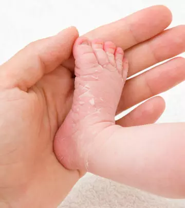 3 Reasons Your Baby’s Skin Is Dry And What You Can Do About It