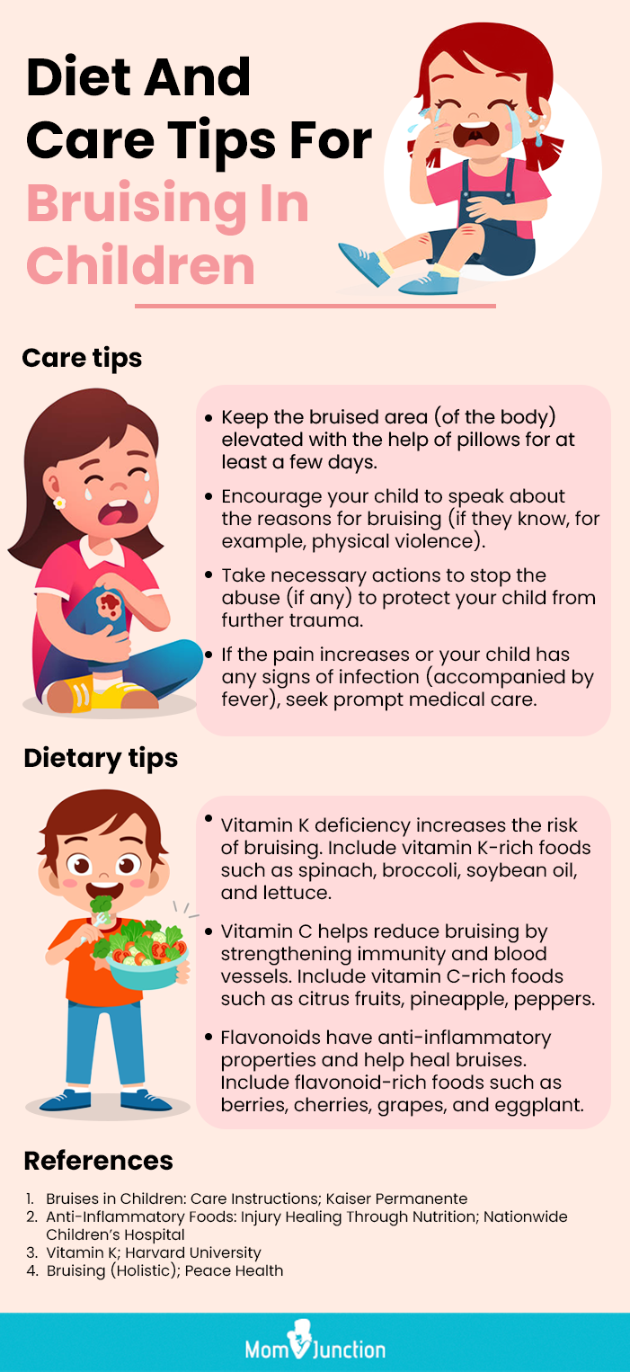 diet and care tips for bruising in children (infographic)