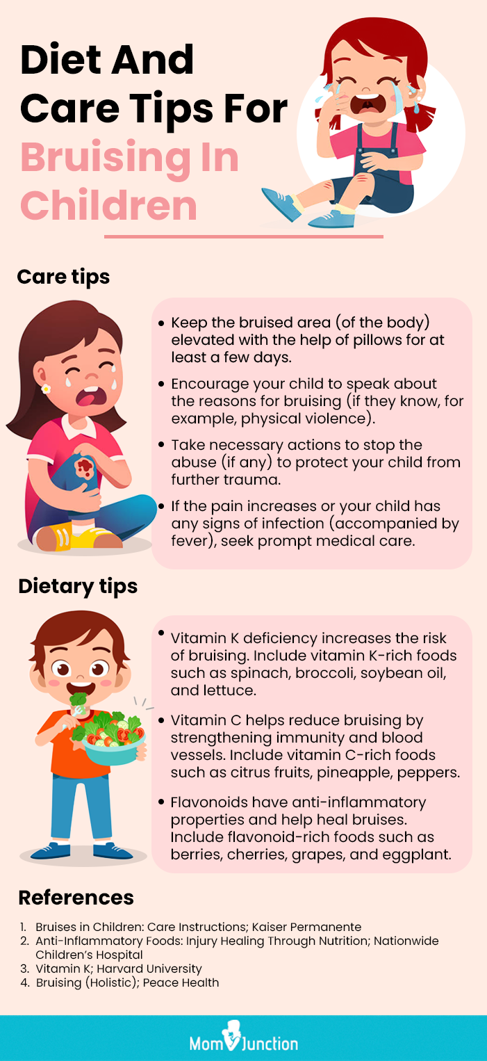儿童瘀伤的饮食及护理提示(信息图)