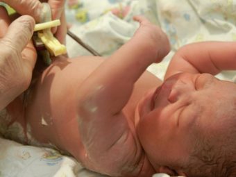 How To Clean The Umbilical Cord Stump Of A Newborn Baby