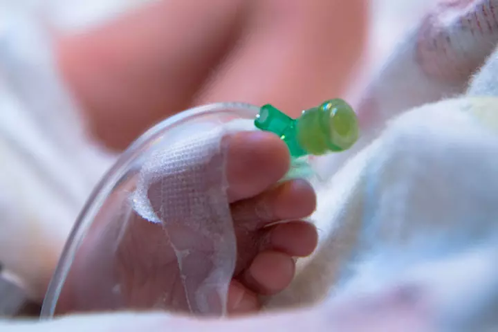 IV fluid administration to a premature infant