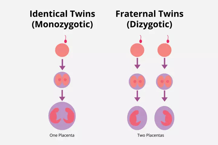 IVF treatment may help conceive twins