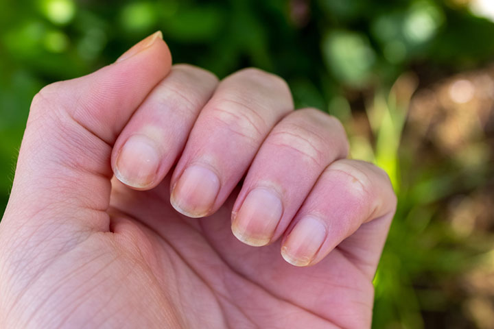 Acrylic nails may damage your natural nails.