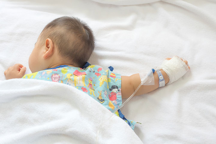 Babies with severe dehydration may require IV fluid