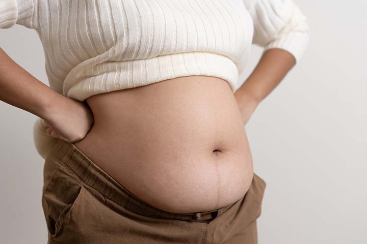 Being overweight is a risk factor for incomplete abortion
