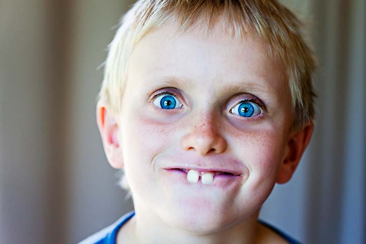 龅牙可能妨碍一个人的容貌。