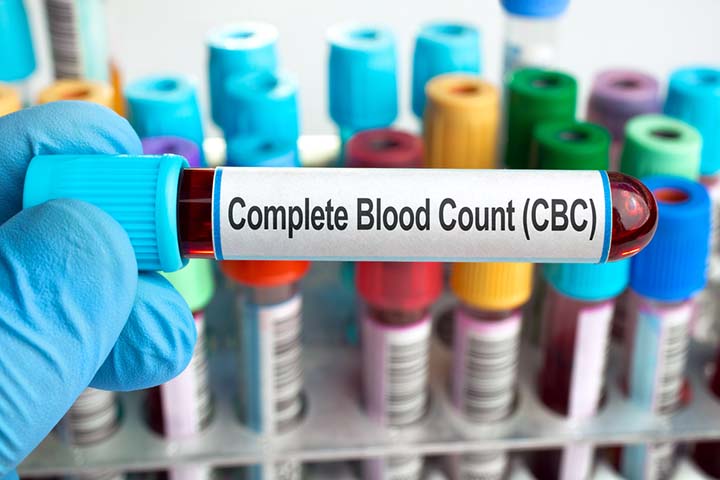 CBC test during pregnancy can help detect anemia