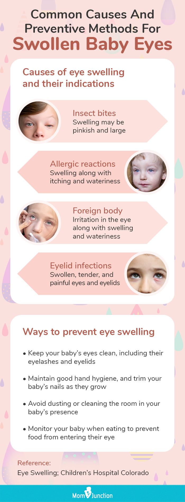 causes and preventive methods for swollen baby [infographic]