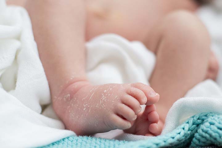 Dehydration can cause urate crystals in the diaper of a newborn