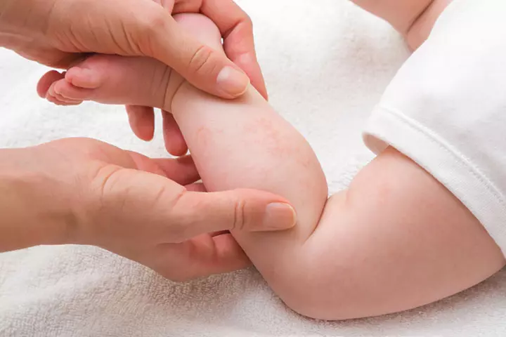 Don’t Allow Skin Allergies