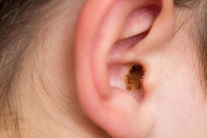 Earwax is formed from keratin, sweat, and sebum.