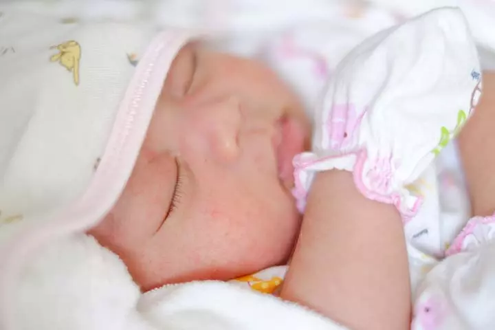 Erythema toxicum in newborns rashes may start on the face