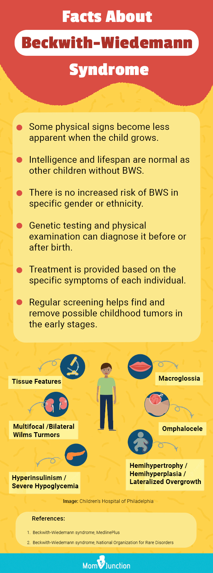 facts about beckwith wiedemann syndrome [infographic]