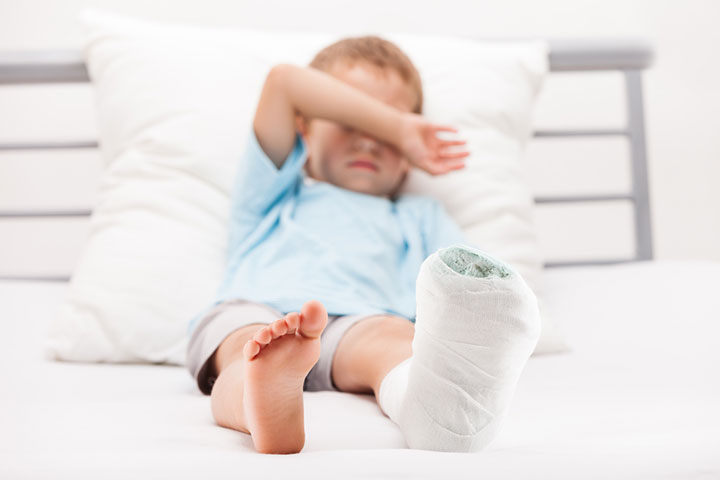 Fractures can lead to heel pain in children