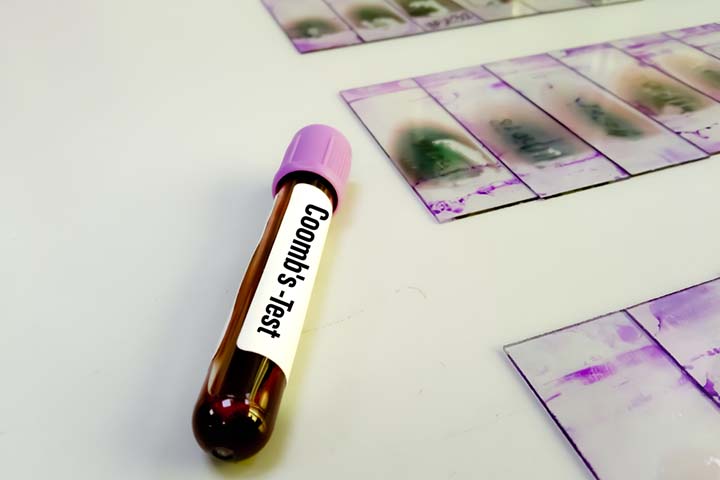 Indirect Coombs test detects free antibodies in the blood. 