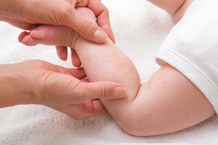 Infants may develop rashes due to excess oil that is left on the skin for a long time