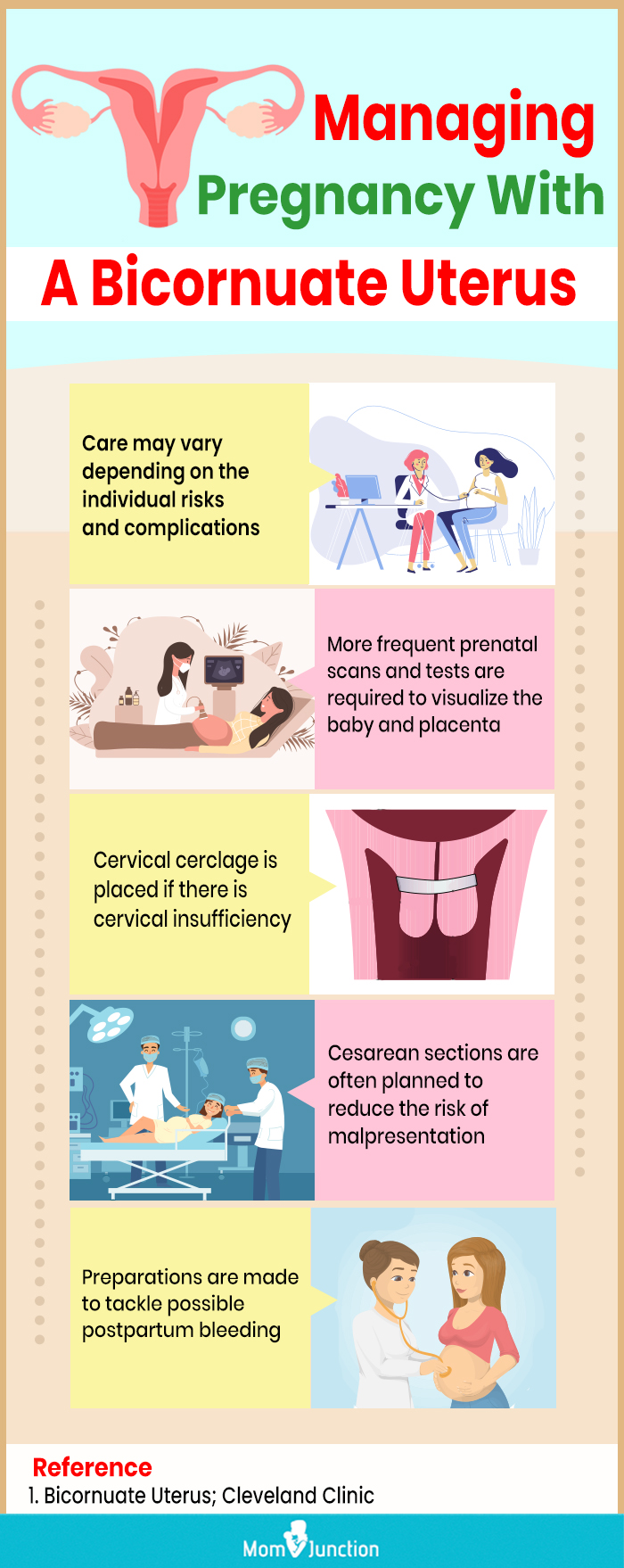 managing pregnancy with a bicornuate uterus (infographic)