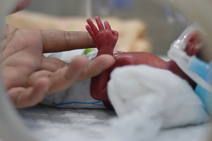 Premature babies need incubation since they cannot regulate their body temperature