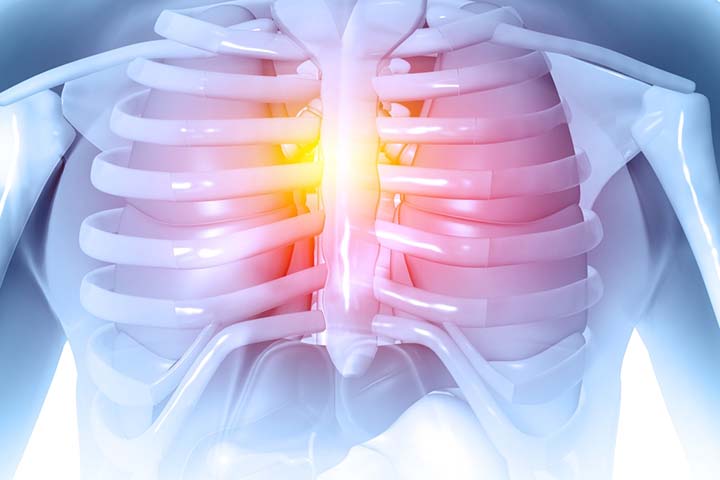 Rib dislocation may lead to chest pain in teenagers