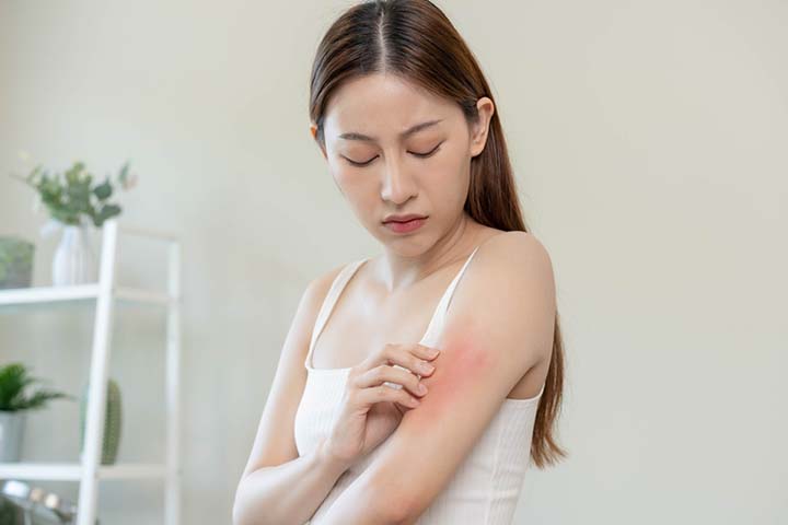 Skin rash is a sign of hemp seed allergy
