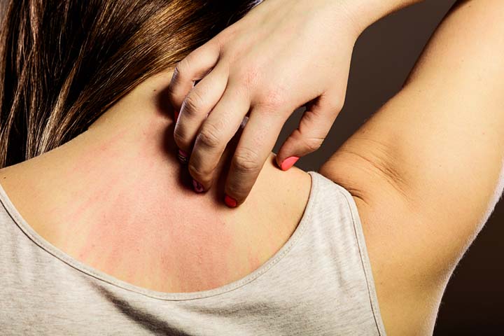 皮疹可能是苯肾上腺素的常见副作用