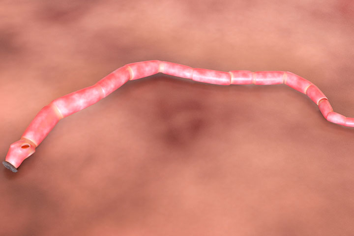 Tapeworm infection in children