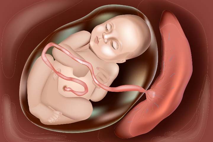 This condition is also known as retained fetal membrane or retained cleansing.