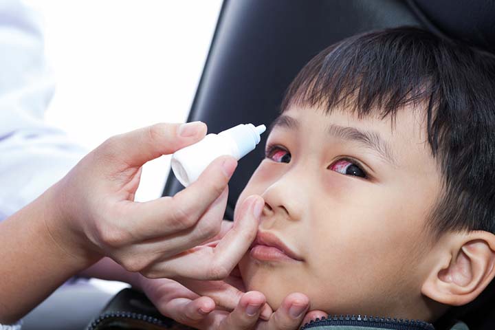 Topical eye drops can treat allergic conjunctivitis in kids