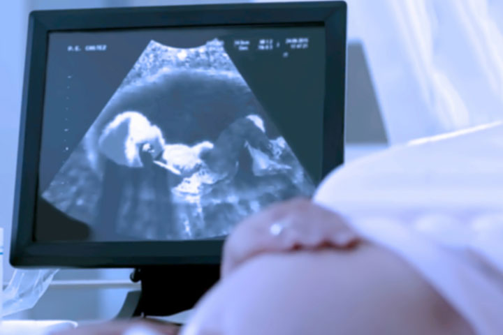 Use an ultrasound scan to determine your baby's sex using the nub theory