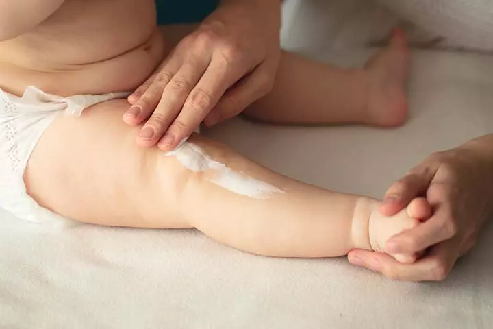 Using lotion may help treat these bites