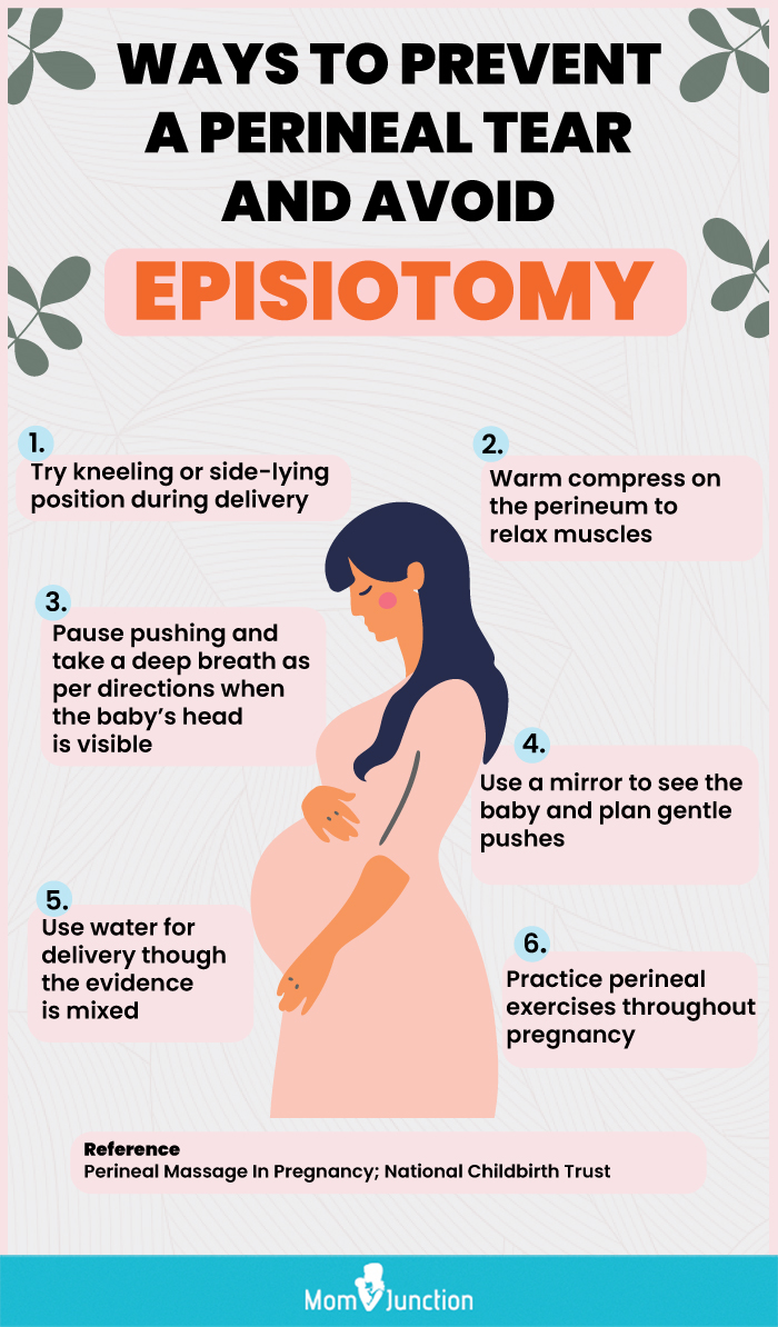 ways to prevent a perineal tear during childbirth (infographic)