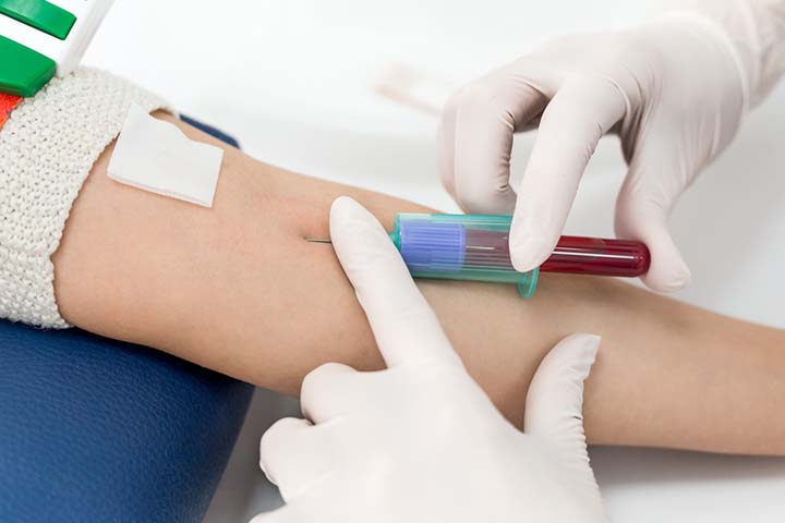 Blood tests help diagnose a chemical pregnancy.