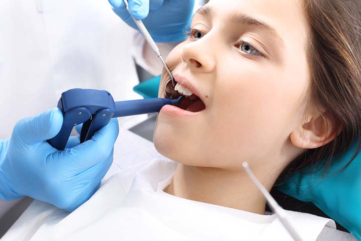 Dental scaling, Treatment for bad breath in children
