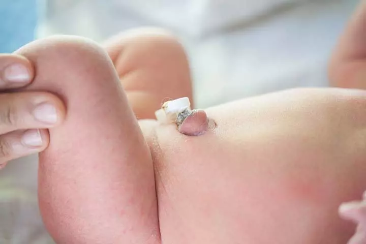 Outie Belly Button And Its Concerns