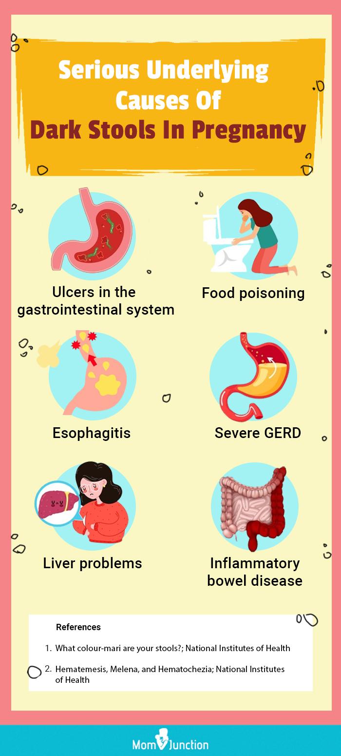 dark stools in pregnancy (infographic)