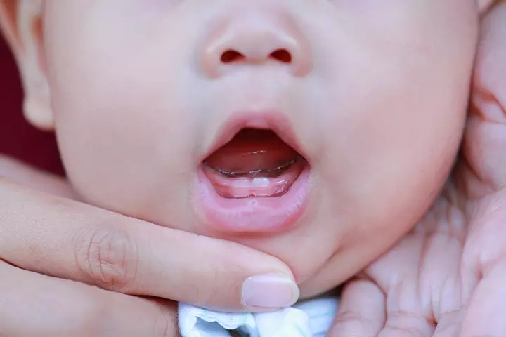 What Is Teething?