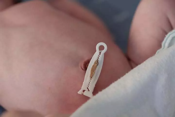 When Do The Stump Fall