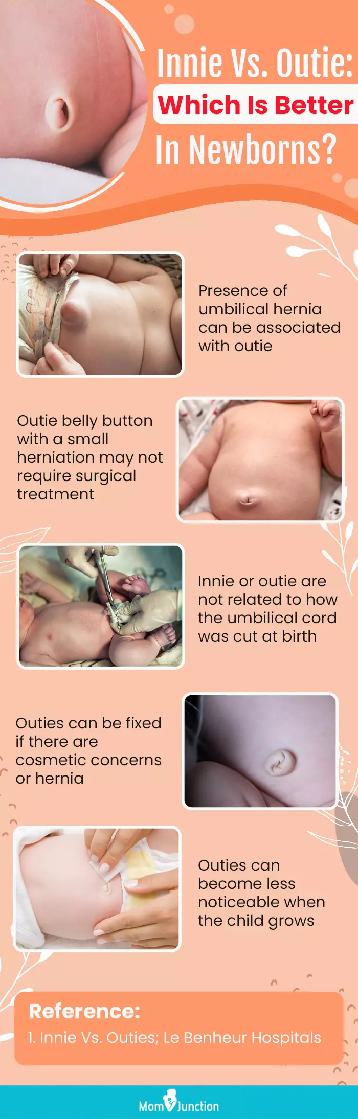 innie vs. outie which is better in newborns (infographic)