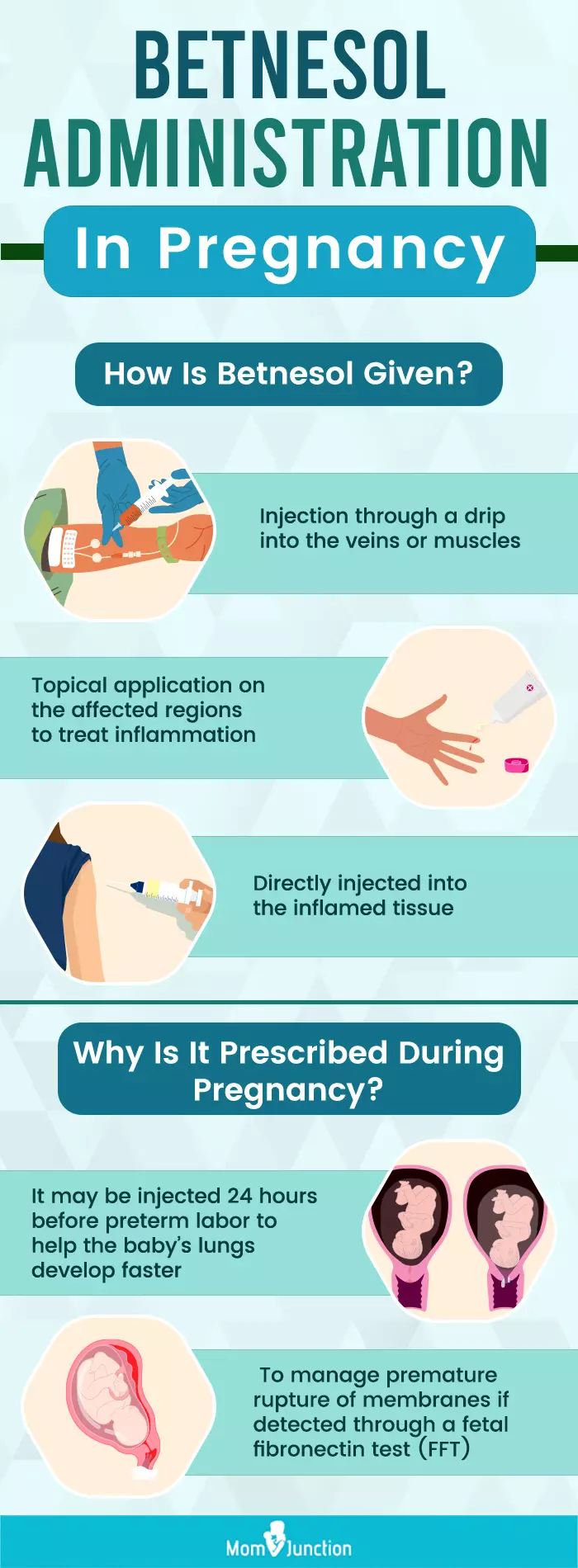 betnesol administration in pregnancy (infographic)