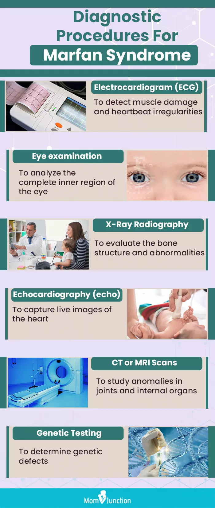 diagonstic procedure for marfan syndrome corrected (infographic)