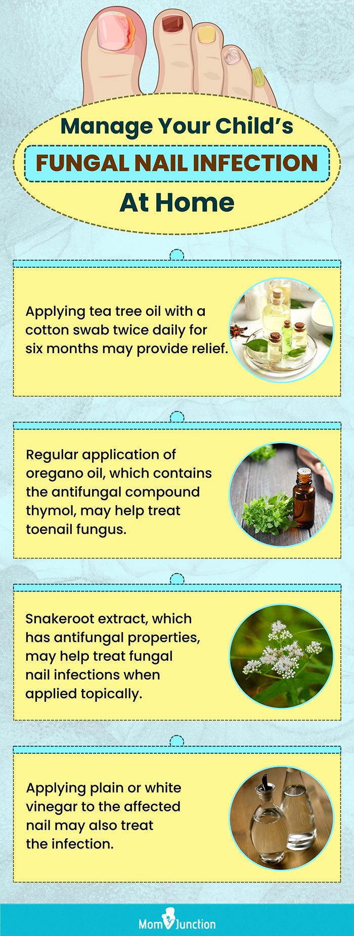 manage your child’s fungal nail infection at home (infographic)