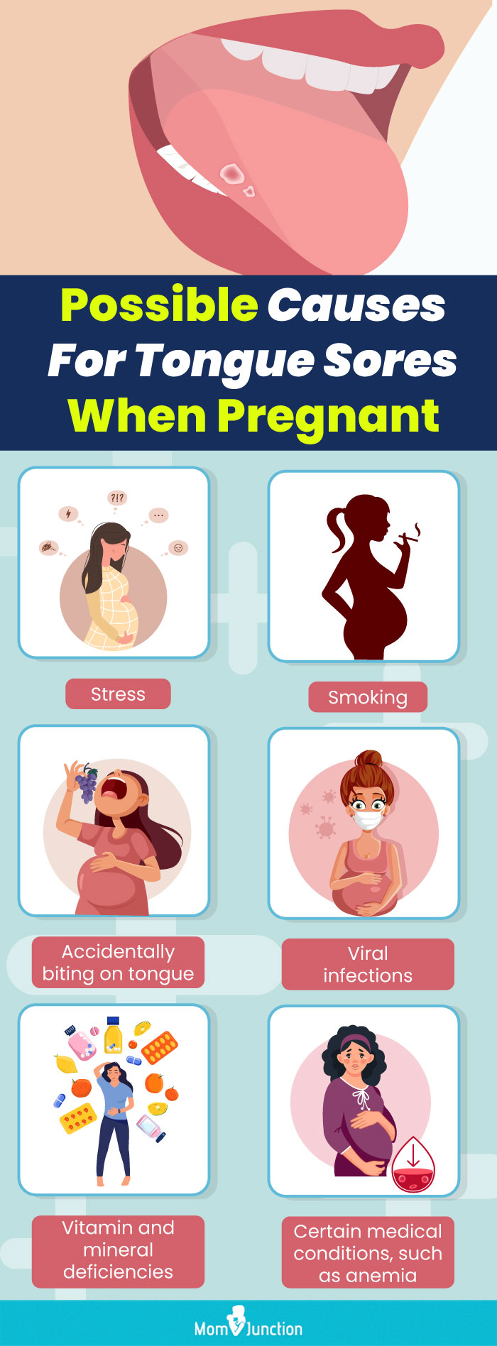 possible causes for tongue sores when pregnant (infographic)