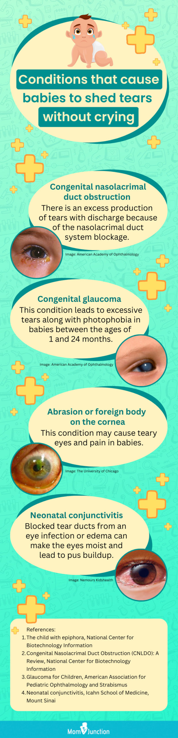 causes of excessive tears in babies (infographic)