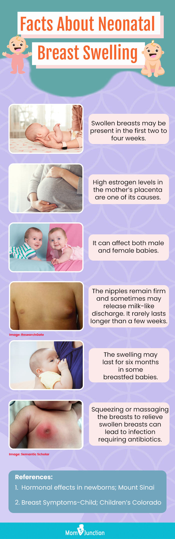 facts about neonatal breast swelling (infographic)